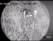 Nir Lazer Aydınlatıcı ile Entegre Lazer Gece Görüş Uzun Menzilli Kızılötesi Kamera